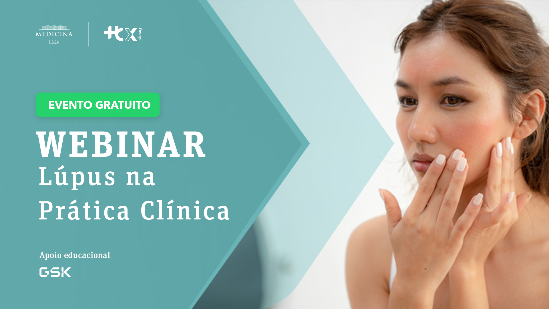 Webinar: Lúpus na Prática Clínica